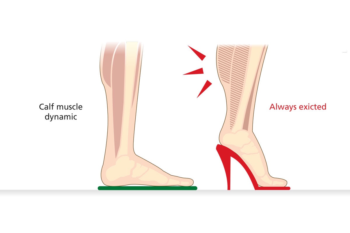 Illustration showing the difference in calf muscle engagement between flat and high-heeled shoes